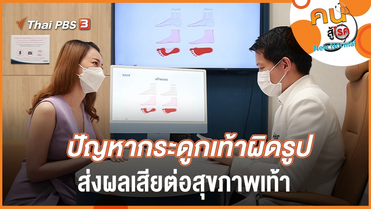 ปัญหากระดูกเท้าผิดรูป ส่งผลเสียต่อสุขภาพเท้า