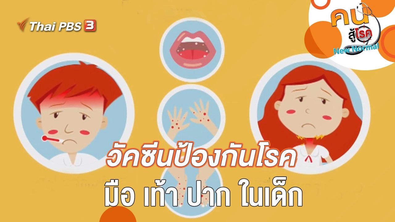 วัคซีนป้องกันโรคมือ เท้า ปาก ในเด็ก