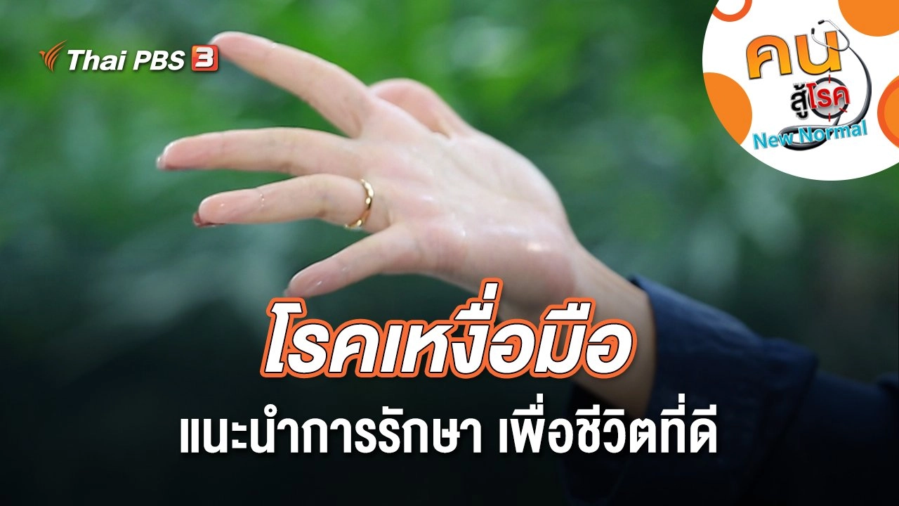โรคเหงื่อมือ