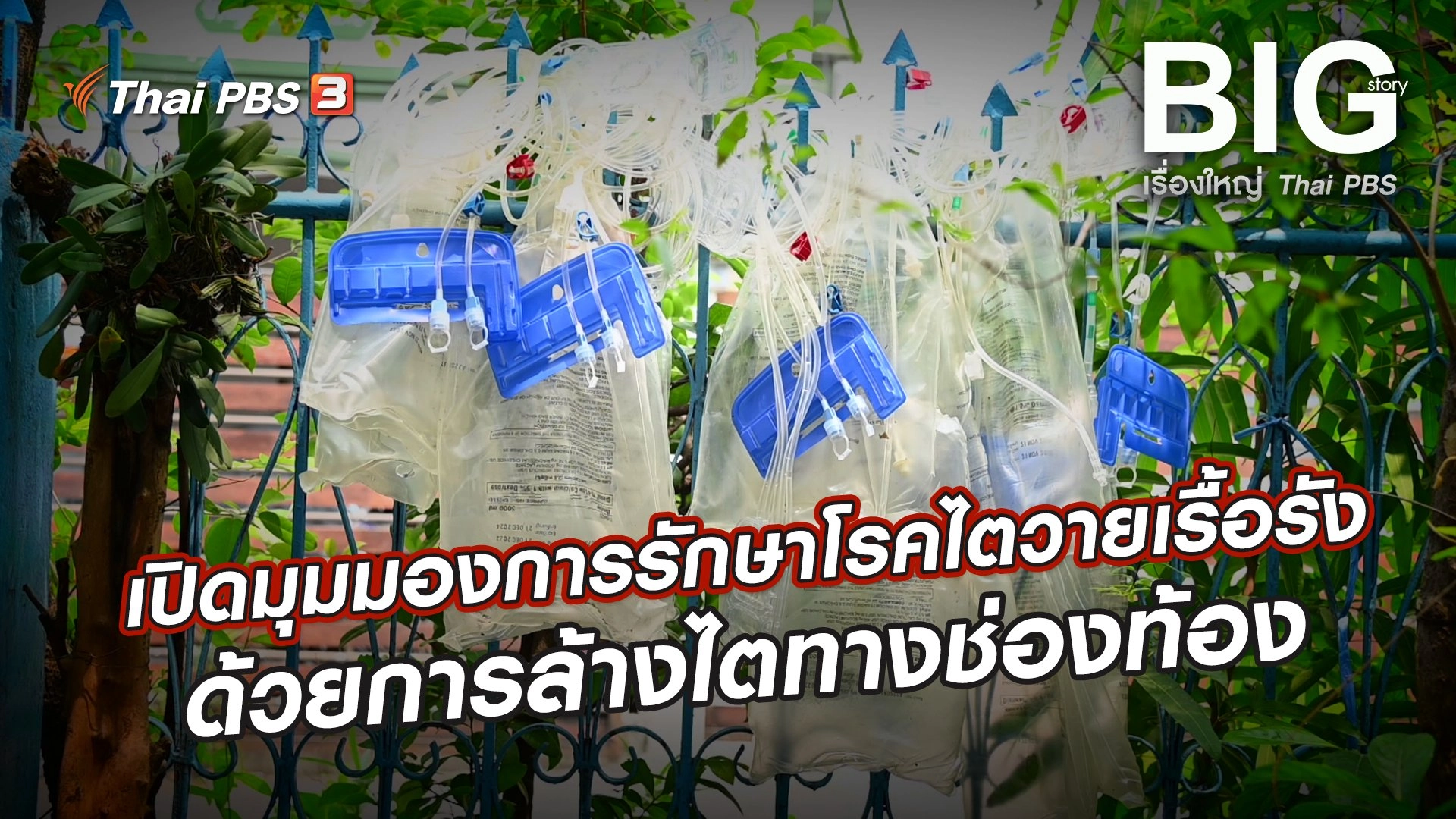 เปิดมุมมองการรักษาโรคไตวายเรื้อรังด้วยการล้างไตทางช่องท้อง