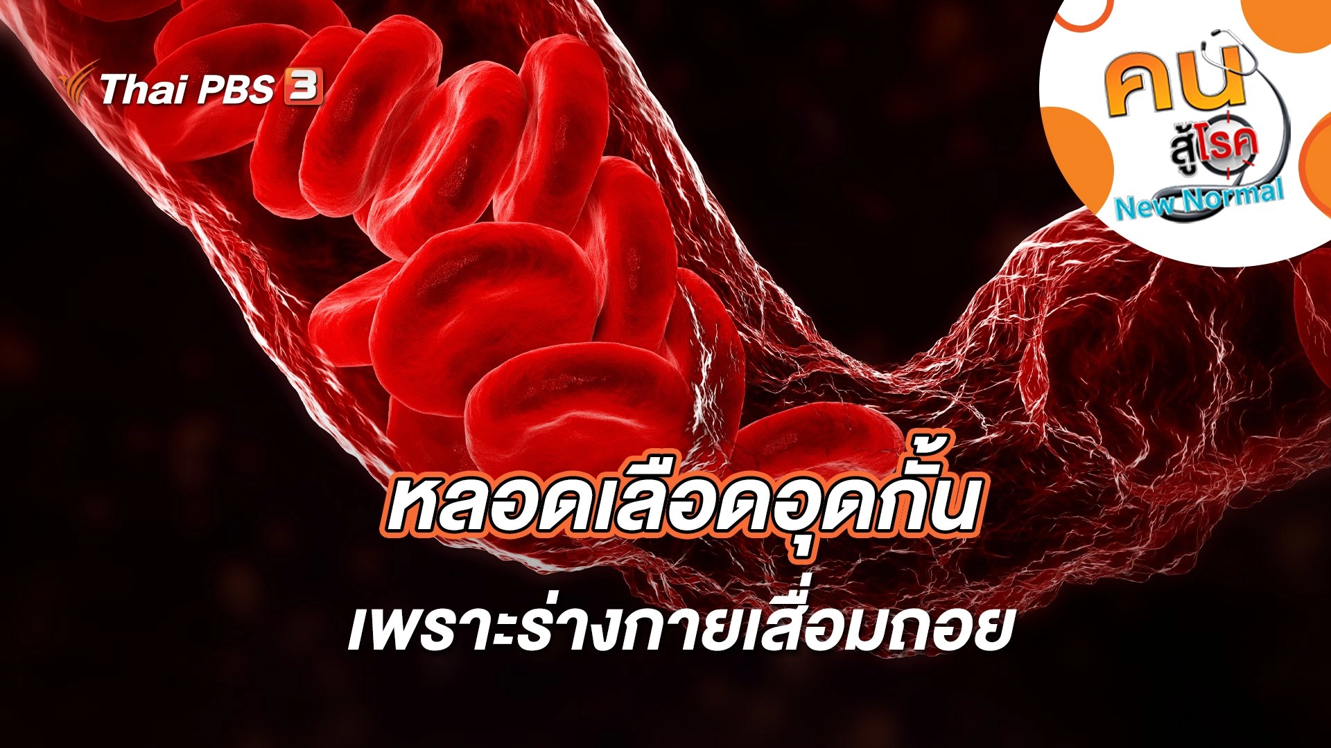 หลอดเลือดอุดกั้นเพราะร่างกายเสื่อมถอย