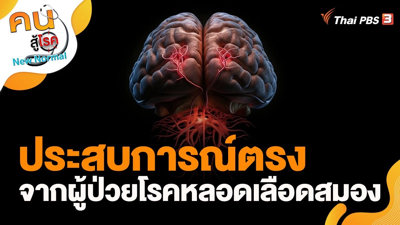 ประสบการณ์ตรงจากผู้ป่วยโรคหลอดเลือดสมอง
