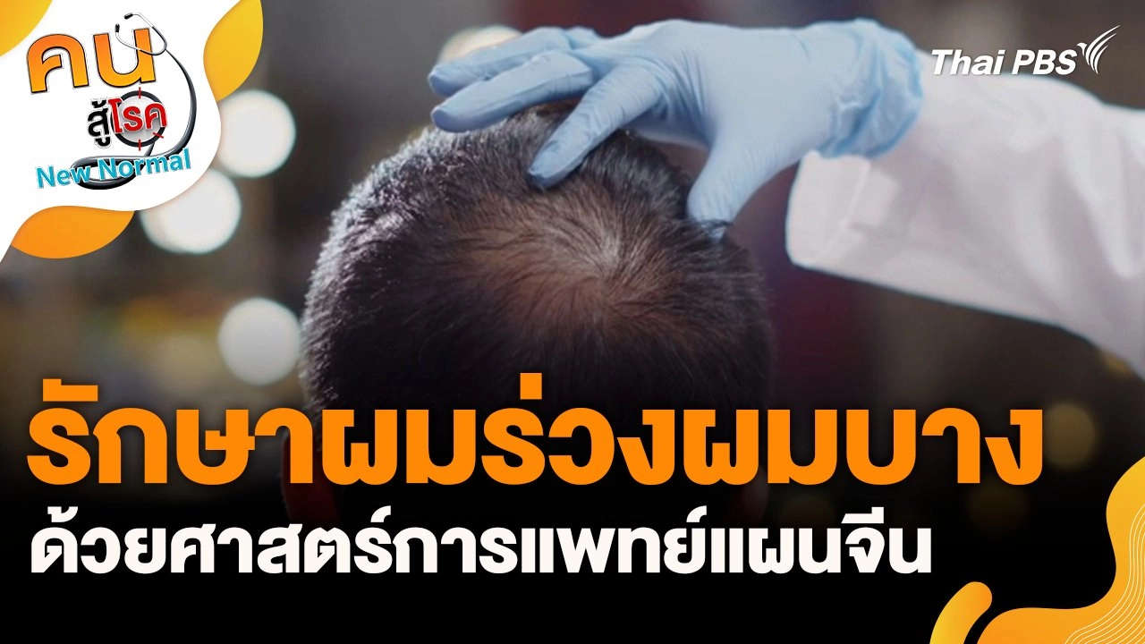 รักษาผมร่วงผมบางด้วยศาสตร์การแพทย์แผนจีน