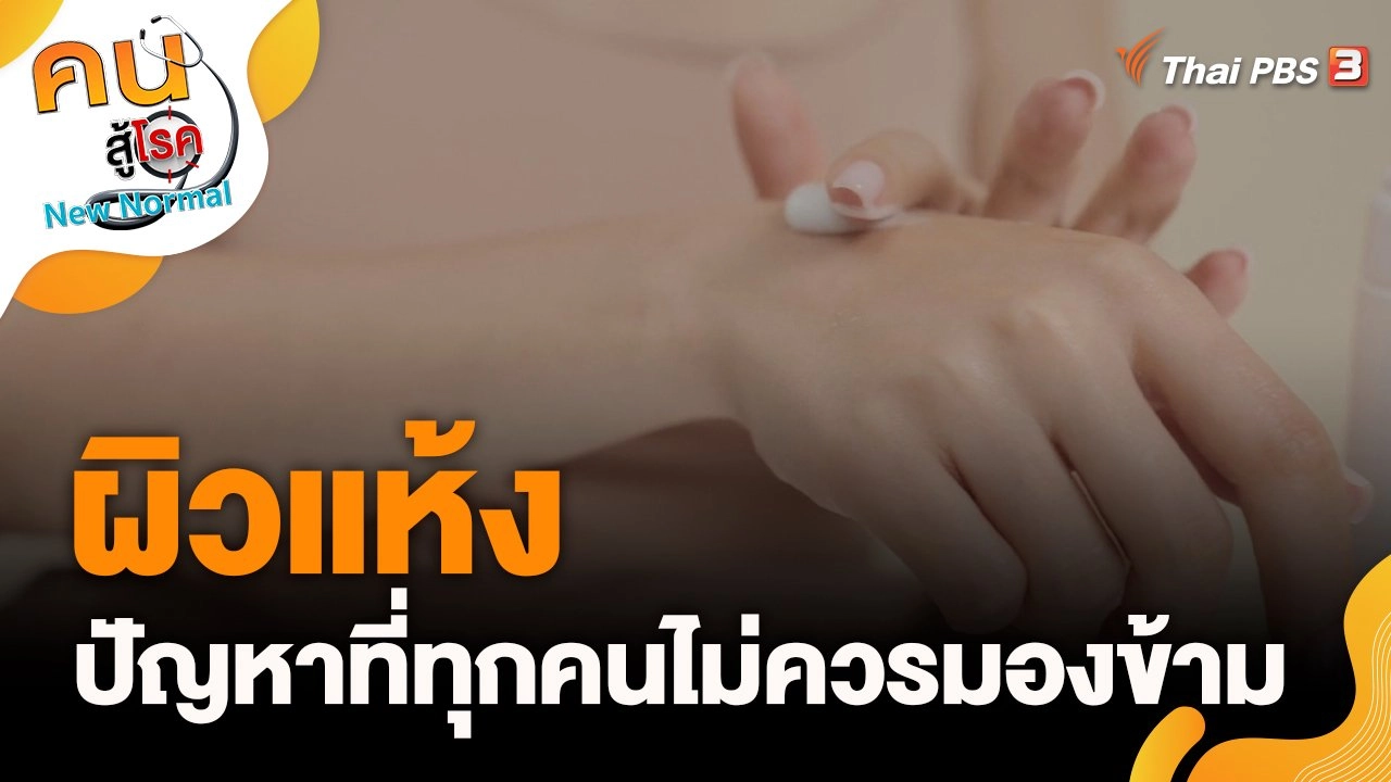 ผิวแห้งปัญหาที่ทุกคนไม่ควรมองข้าม