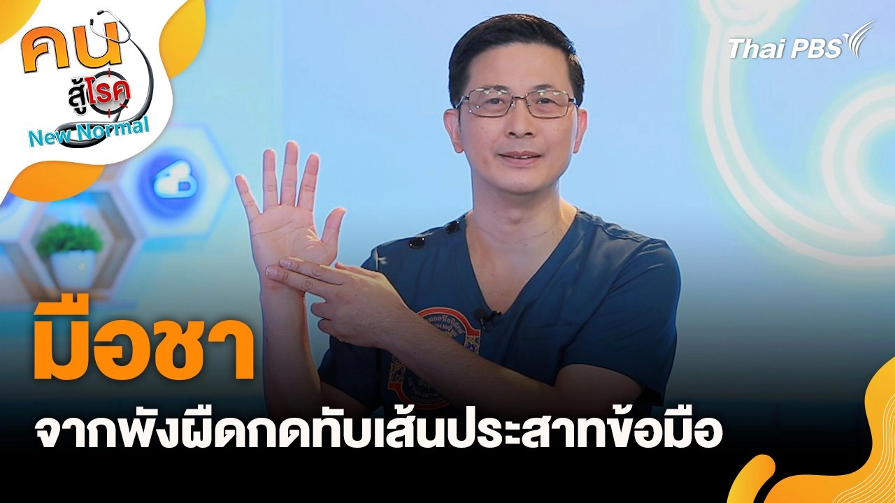 มือชาจากพังผืดกดทับเส้นประสาทข้อมือ