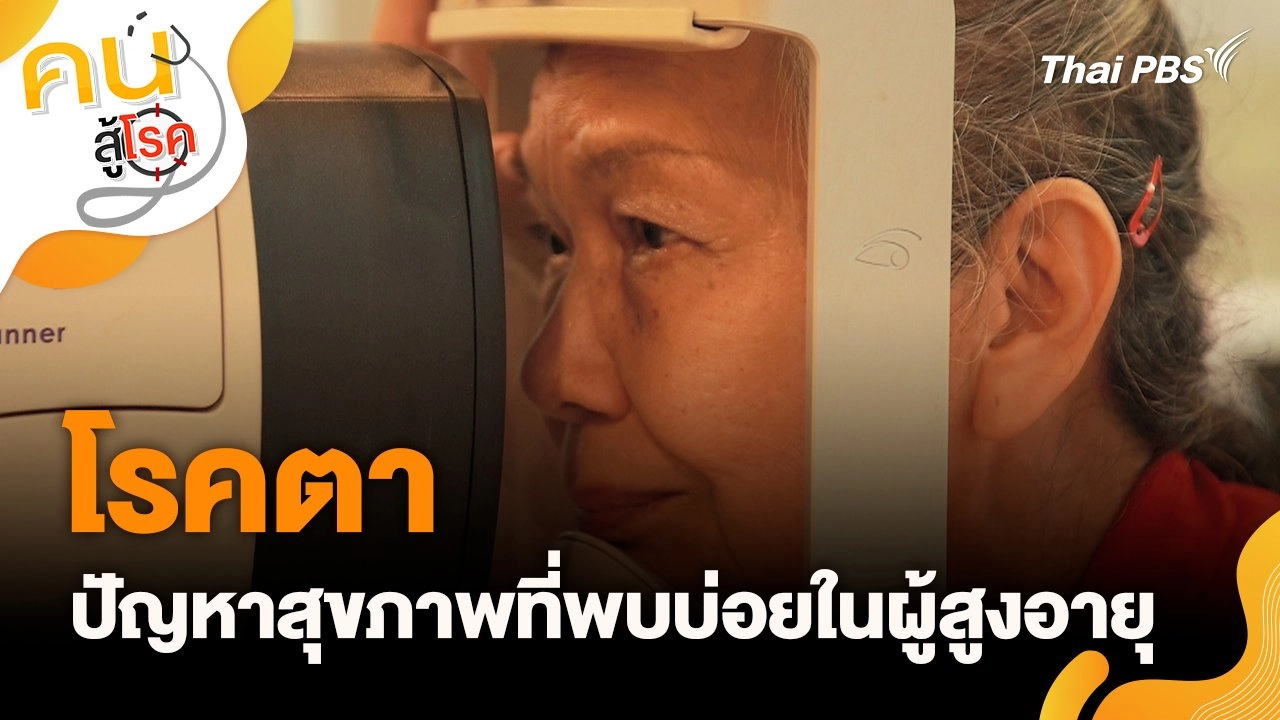 โรคตาปัญหาสุขภาพที่พบบ่อยในผู้สูงอายุ