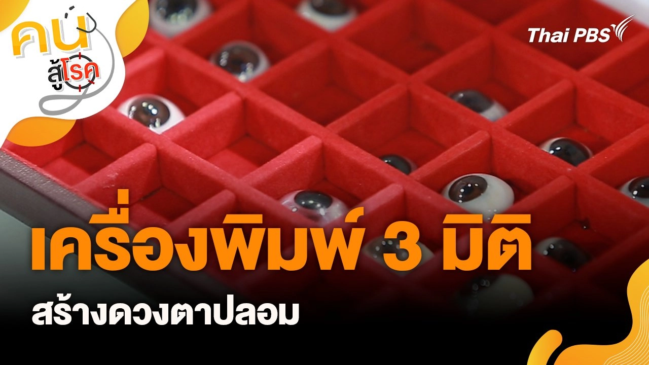 เครื่องพิมพ์ 3 มิติ สร้างดวงตาปลอม