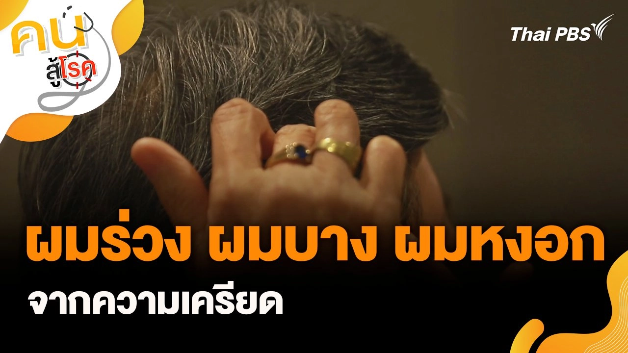 ผมร่วง ผมบาง ผมหงอก จากความเครียด