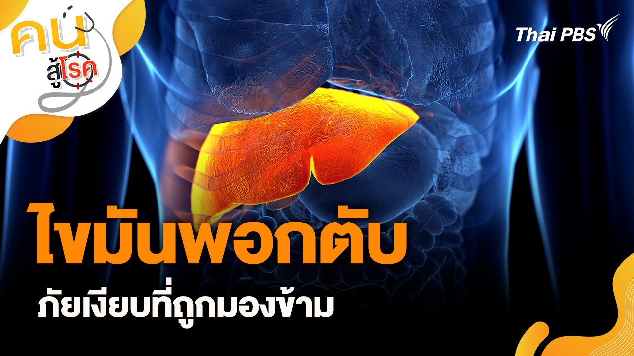 ไขมันพอกตับ ภัยเงียบที่ถูกมองข้าม