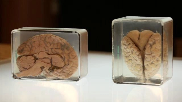 เพชรฆาตความเครียด