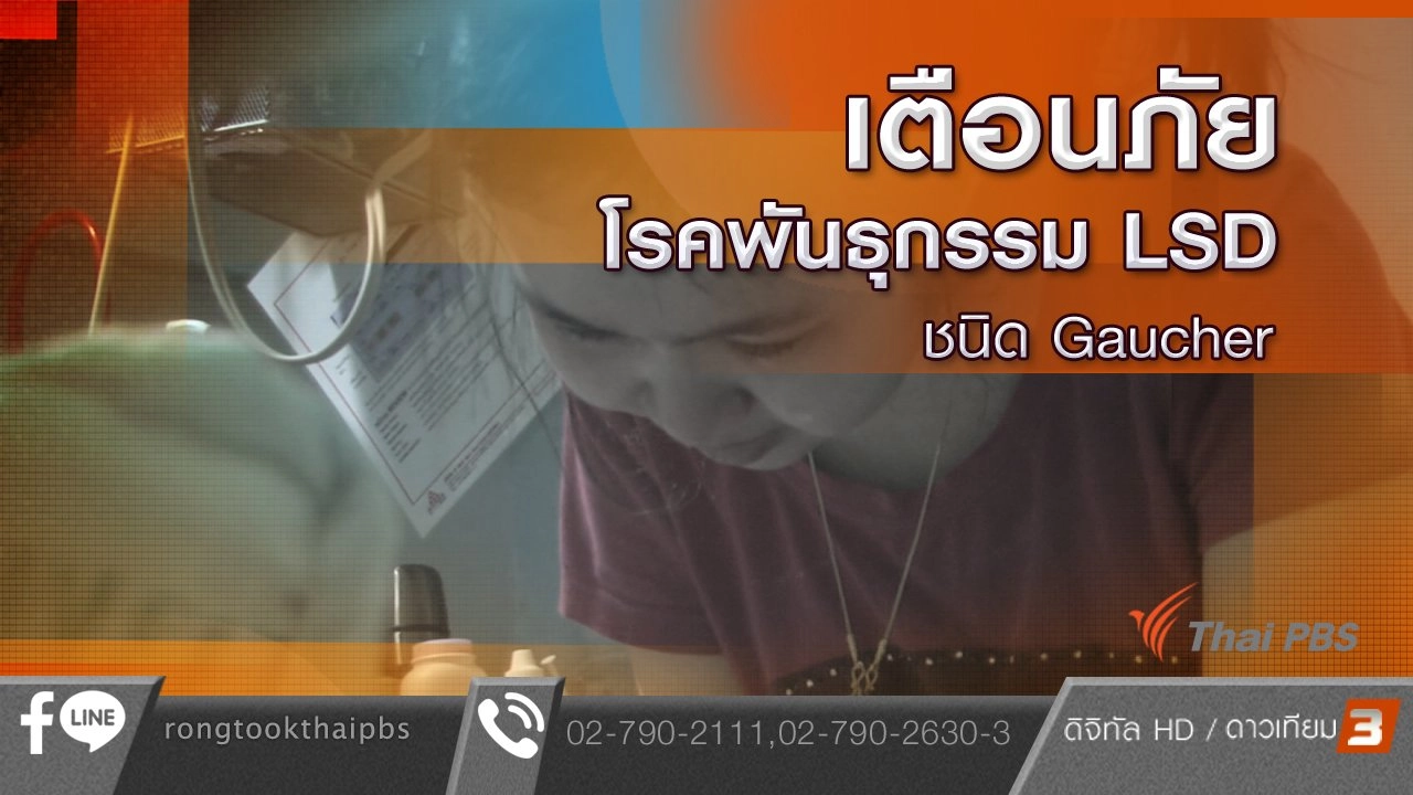 เตือนภัยโรคพันธุกรรม LSD ชนิด Gaucher