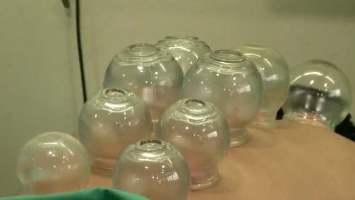 “ครอบแก้ว” รักษาโรค..ดังไกลโอลิมปิก 2016, สมุนไพรสระผมทำใช้เอง ได้สร้างรายได้ดี, ปลาร้าทรงเครื่อง