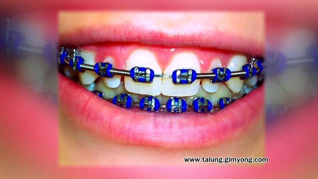 จัดฟันแฟชั่นอาจตายได้, ขจัดกลิ่นคาวติดเขียง, สาวใต้หัวใจนายช่าง