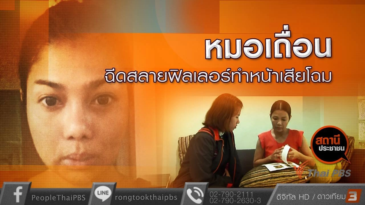 หมอเถื่อนฉีดสารสลายฟิลเลอร์ทำหน้าเสียโฉม