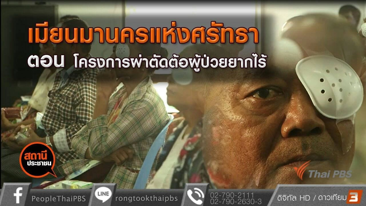 เมียนมานครแห่งศรัทธา ตอน โครงการผ่าตัดต้อผู้ป่วยยากไร้