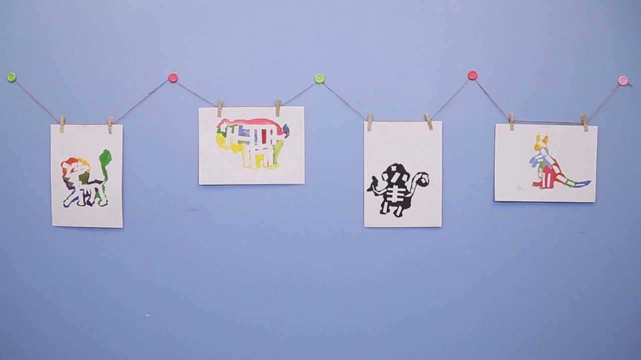 เอ็กซเรย์ (X-RAY)