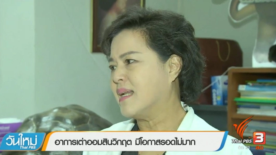 ประเด็นข่าว (21 มี.ค. 60)