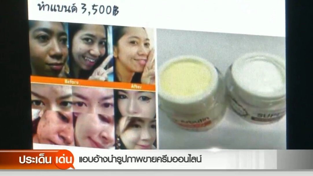 แอบอ้างนำรูปภาพขายครีมออนไลน์