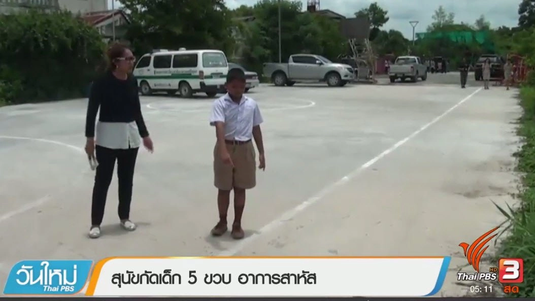 ประเด็นข่าว (25 ก.ค. 60)