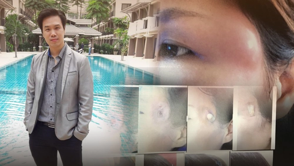 คุยข่าวกับหมอกอล์ฟ เตือนภัยพิษศัลยกรรม ฉีดโบท็อกซ์ติดเชื้อขมับยุบ