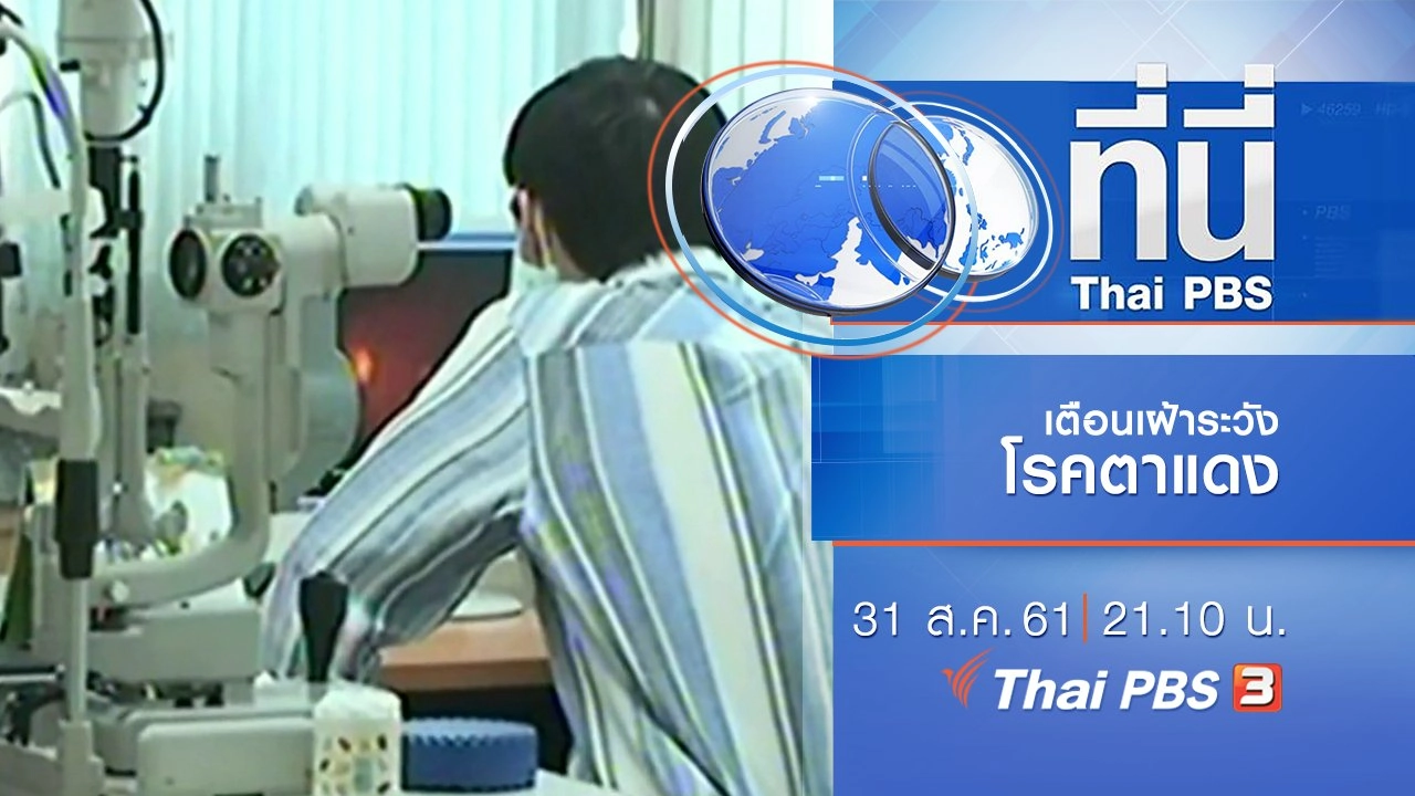 ประเด็นข่าว ( 31 ส.ค. 61)