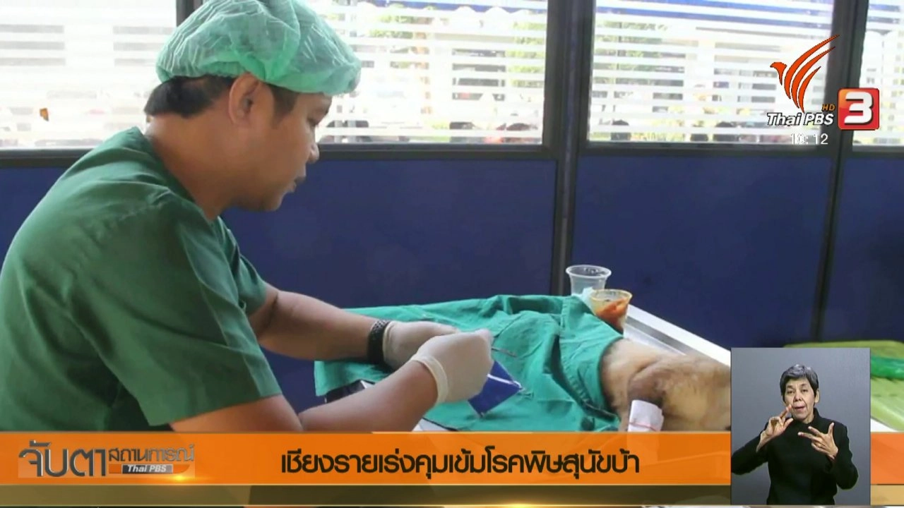 ประเด็นข่าว (25 เม.ย. 61)