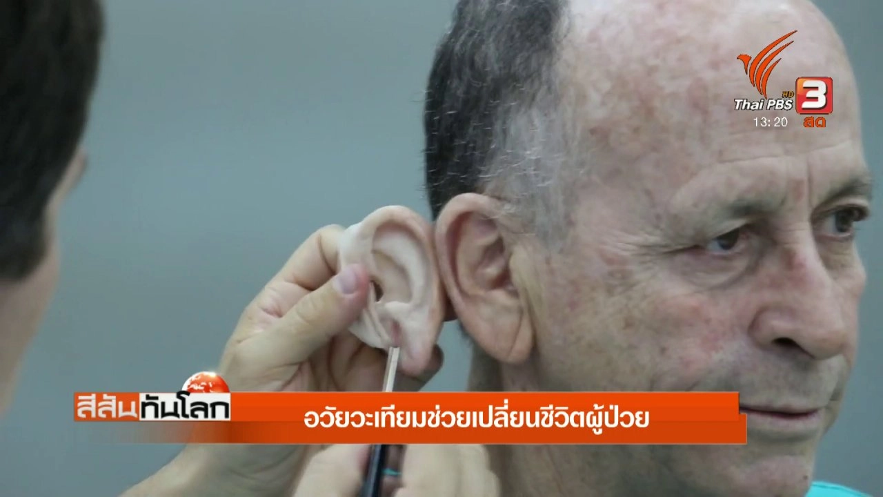 ประเด็นข่าว (28 เม.ย. 61)