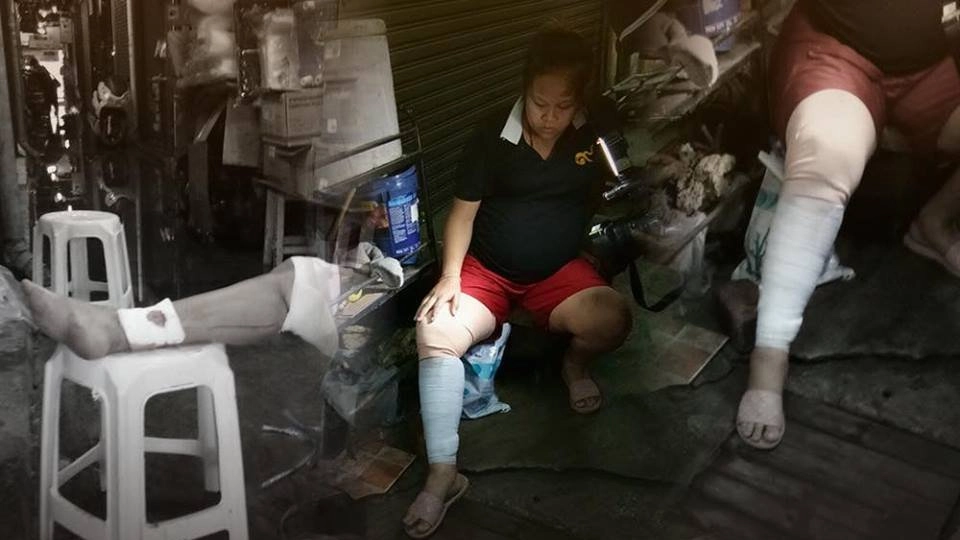 หญิงท้อง 8 เดือนเดินตกท่อระบายน้ำ เย็บ 42 เข็ม เขตจตุจักร กทม.