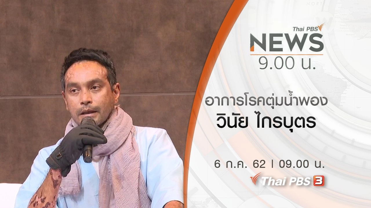 ประเด็นข่าว (6 ก.ค. 62)