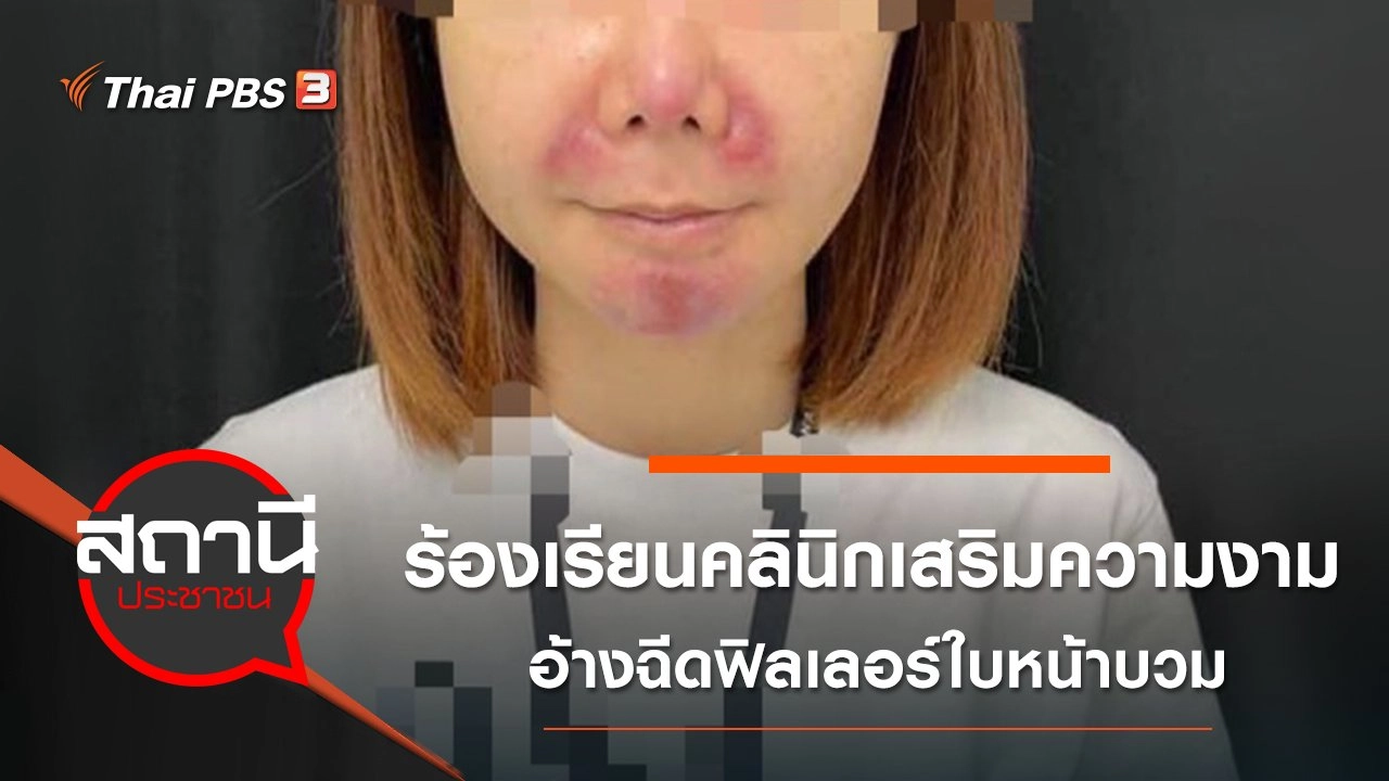 ร้องเรียนคลินิกเสริมความงามอ้างฉีดฟิลเลอร์ใบหน้าบวม