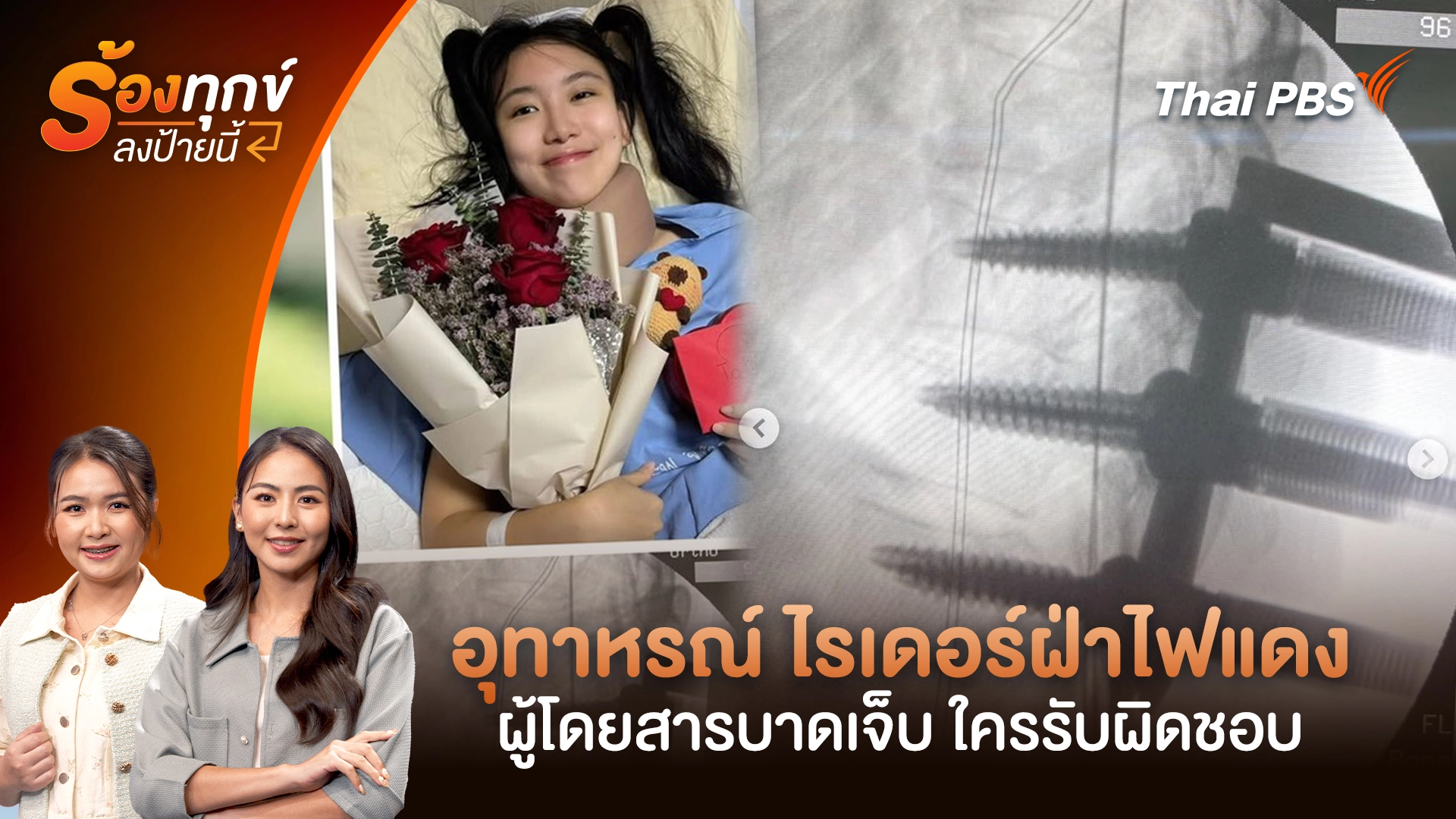 อุทาหรณ์ ไรเดอร์ฝ่าไฟแดง ผู้โดยสารบาดเจ็บ ใครรับผิดชอบ