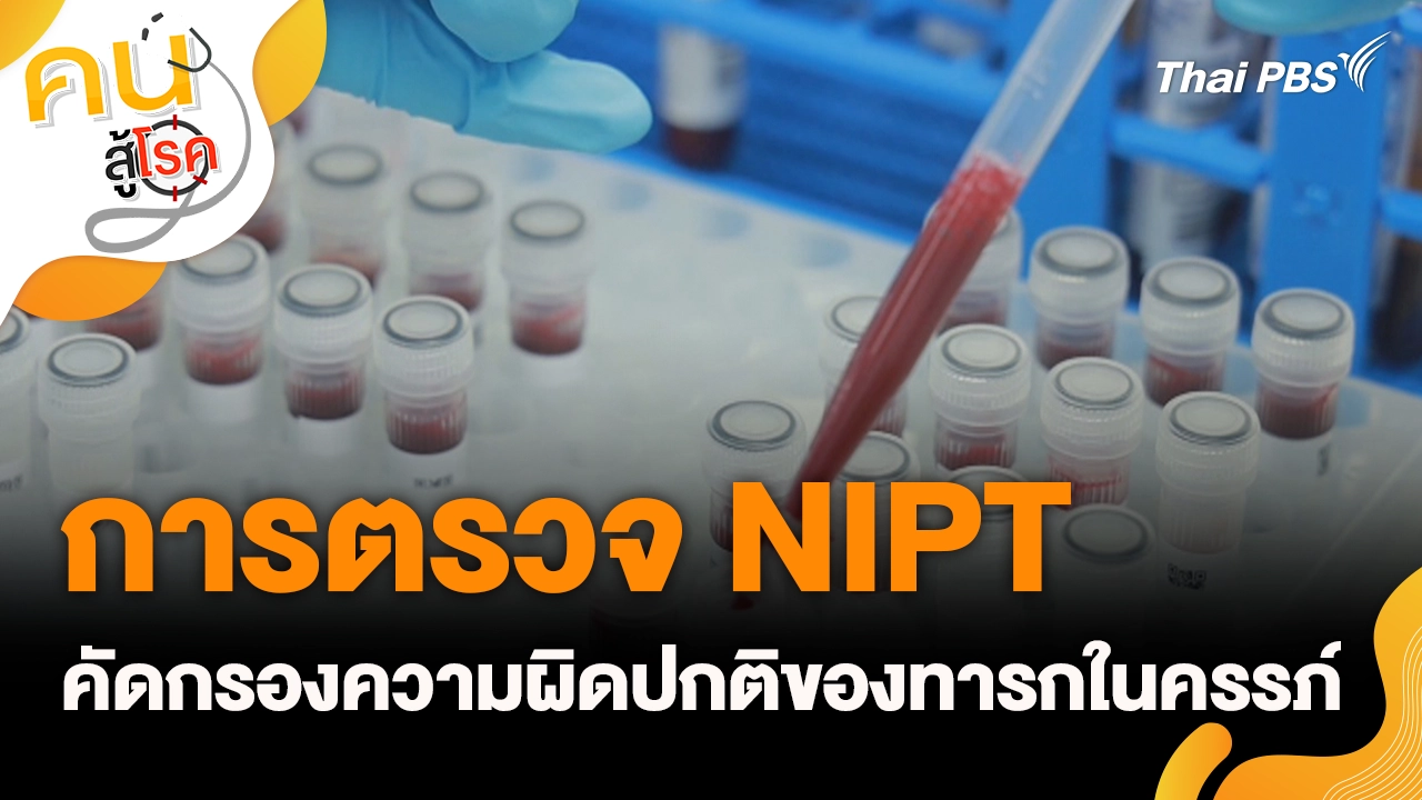 การตรวจ NIPT คัดกรองความผิดปกติของทารกในครรภ์