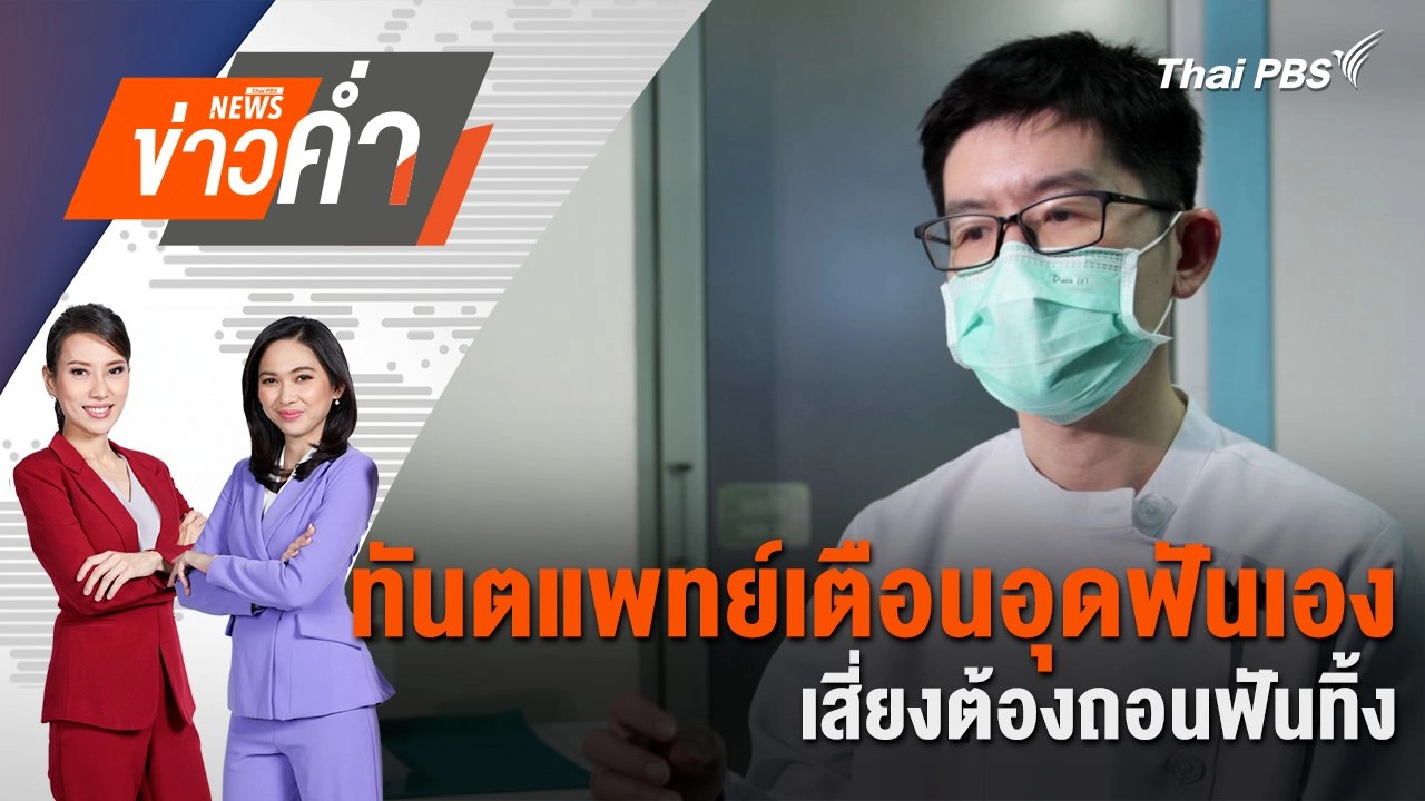 ทันตแพทย์เตือนอุดฟันเองเสี่ยงต้องถอนฟันทิ้ง | 12 ม.ค. 68