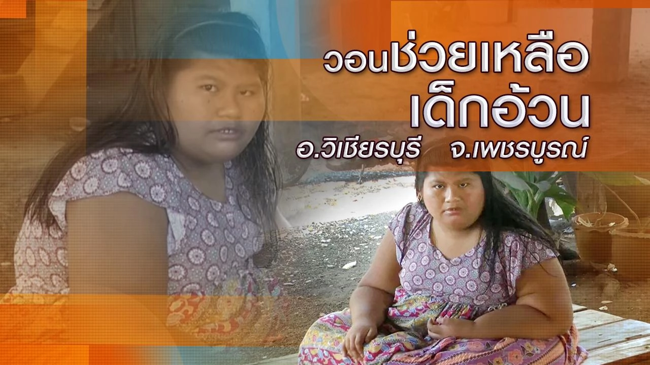 วอนช่วยเหลือเด็กอ้วน อ.วิเชียรบุรี จ.เพชรบูรณ์