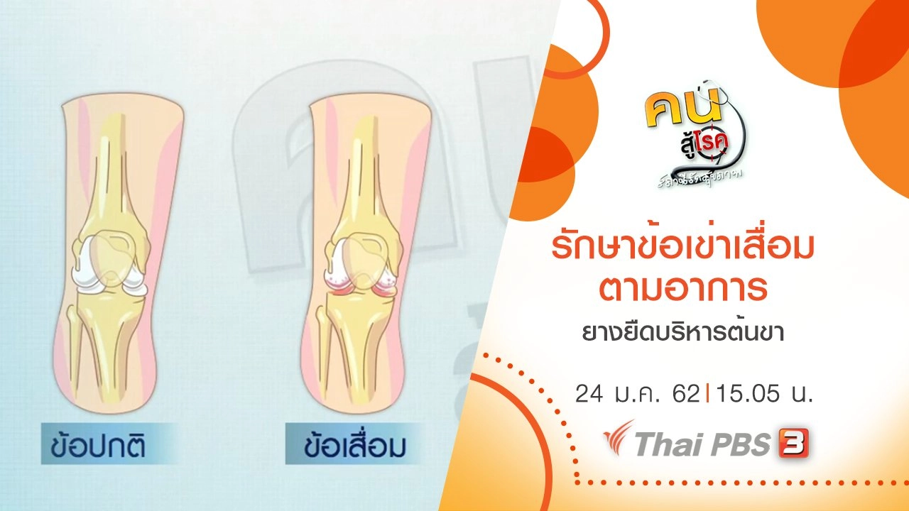 รักษาข้อเข่าเสื่อมตามอาการ, ยางยืดบริหารต้นขา