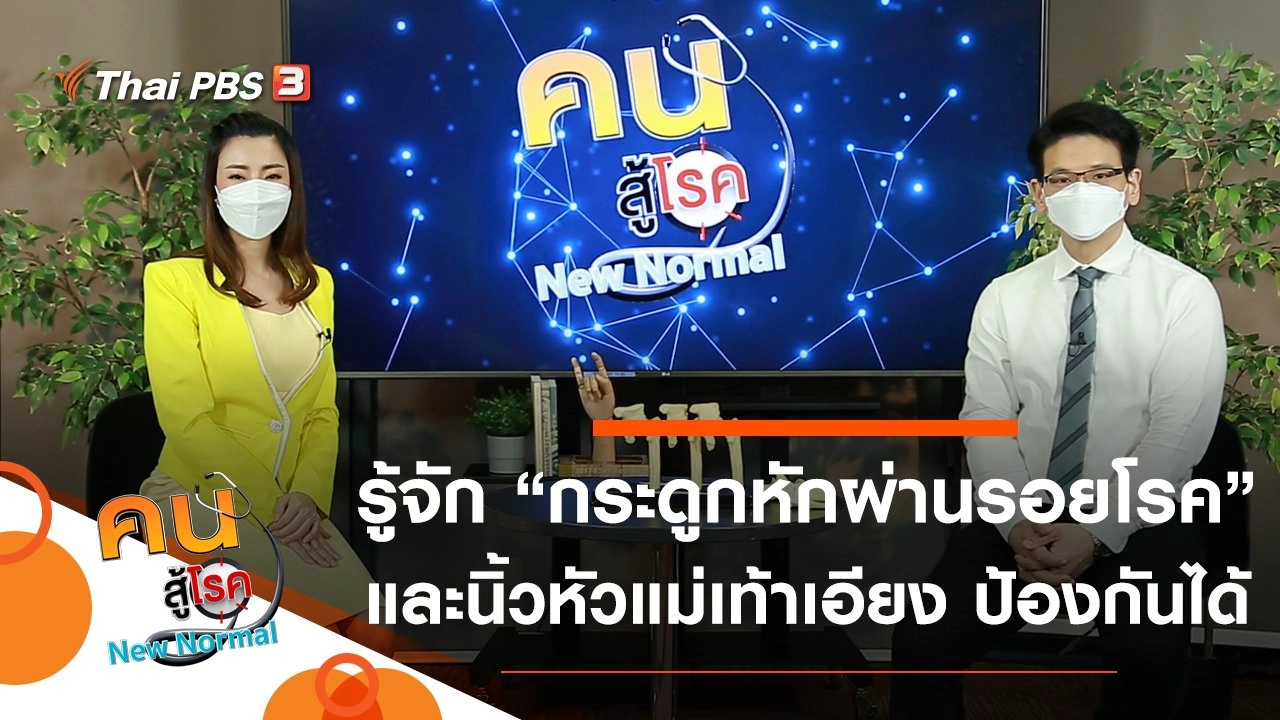 กระดูกหักผ่านรอยโรค, นิ้วหัวแม่เท้าเอียง ป้องกันได้