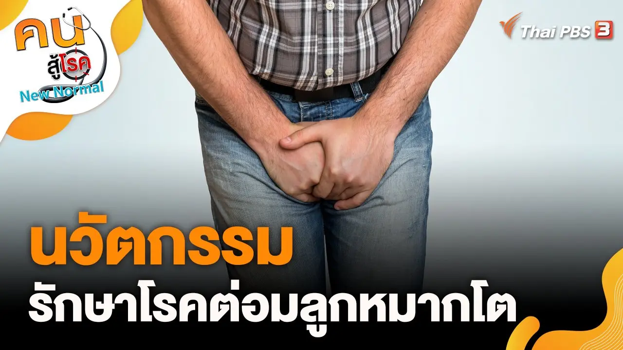 นวัตกรรมในการรักษาโรคต่อมลูกหมากโต