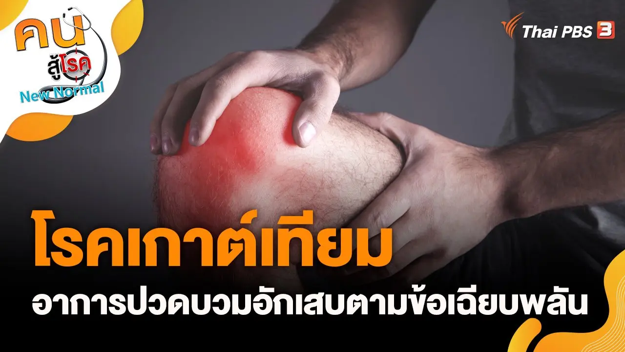 โรคเกาต์เทียม อาการปวดบวมอักเสบตามข้อเฉียบพลัน