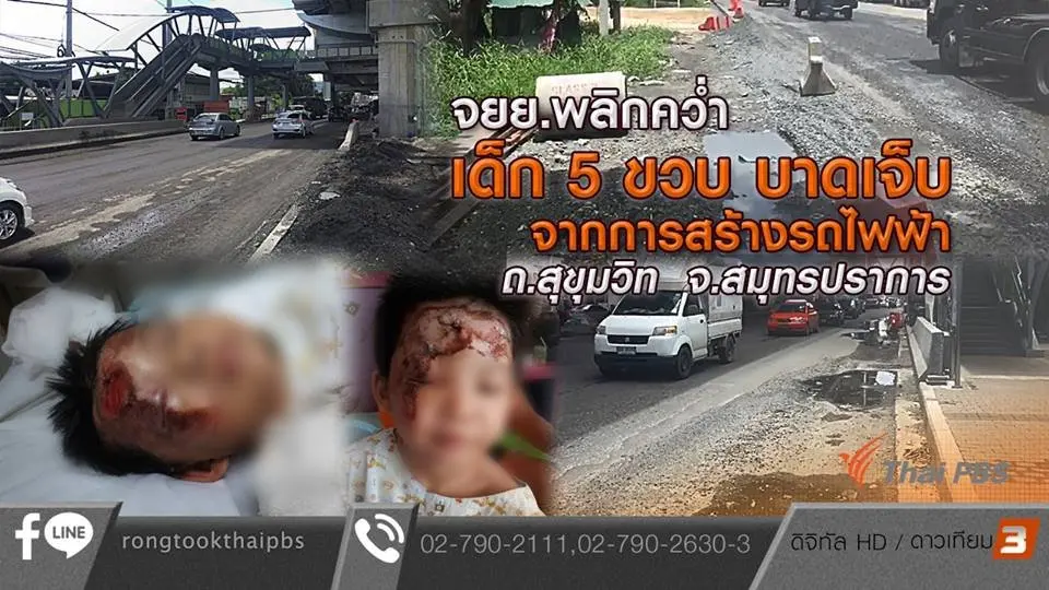 จยย.พลิกคว่ำ เด็ก 5 ขวบบาดเจ็บจากการสร้างรถไฟฟ้า จ.สมุทรปราการ
