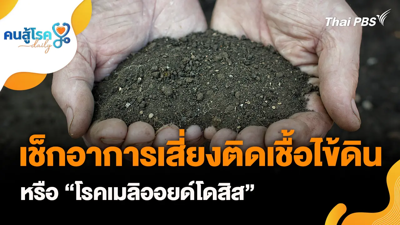 เช็กอาการเสี่ยงติดเชื้อไข้ดิน, น้ำร้อนลวก-ไฟไหม้ ให้รีบทายาสีฟัน จริงหรือ ?