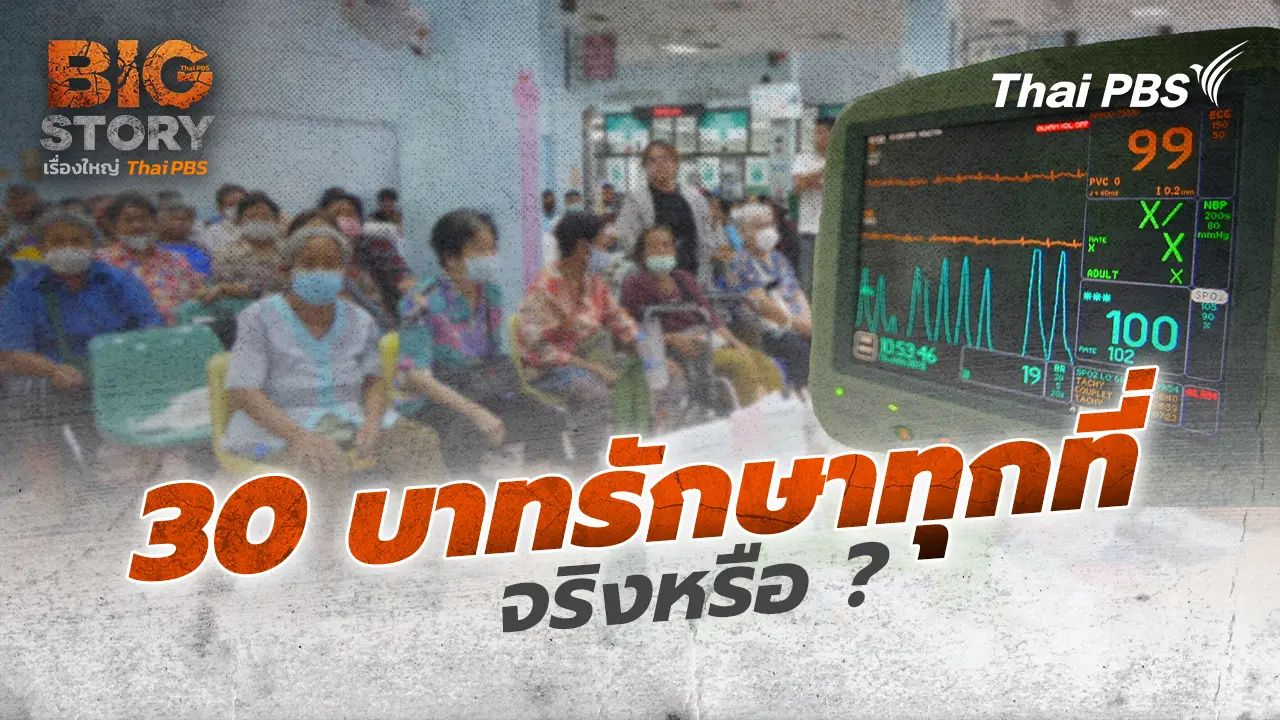 30 บาทรักษาทุกที่ จริงหรือ ?
