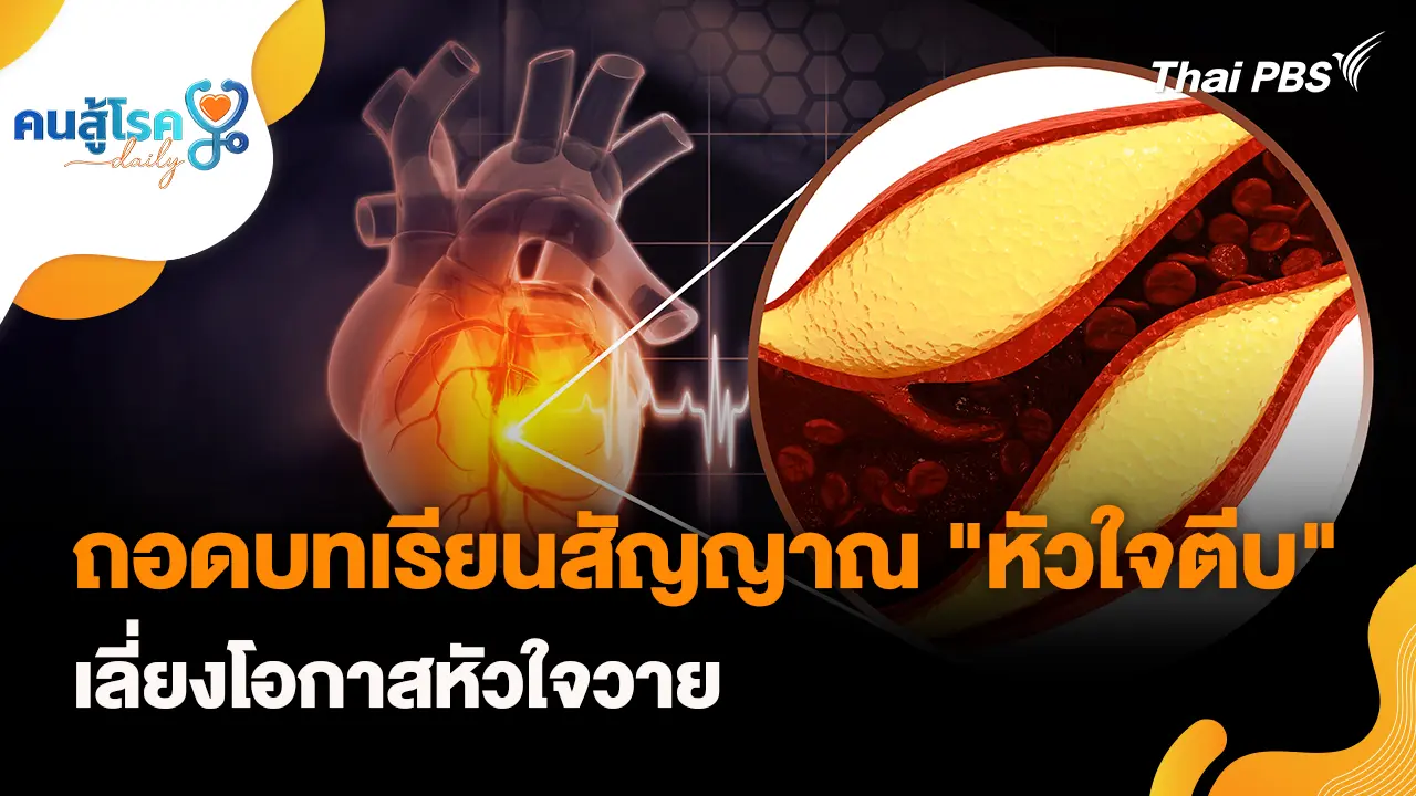ถอดบทเรียนสัญญาณ "หัวใจตีบ" เลี่ยงโอกาสหัวใจวาย