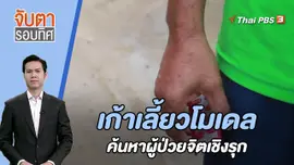 เก้าเลี้ยวโมเดล ค้นหาผู้ป่วยทางจิตเชิงรุก | 18 ส.ค. 66