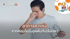 อาการตาแห้งจากต่อมไขมันอุดตันที่เปลือกตา