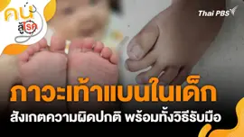 ภาวะเท้าแบนในเด็ก
