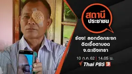 ร้อง! ลอกต้อกระจก ติดเชื้อตาบอด จ.ฉะเชิงเทรา