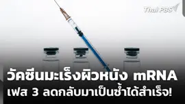 วัคซีนมะเร็งผิวหนัง mRNA เฟส 3 ลดกลับมาเป็นซ้ำได้สำเร็จ