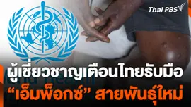 ผู้เชี่ยวชาญเตือนไทยรับมือ "โรคเอ็มพ็อกซ์" สายพันธุ์ใหม่