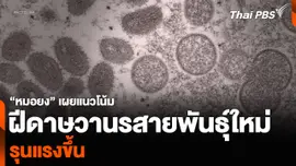 “หมอยง” เผยแนวโน้มฝีดาษวานรสายพันธุ์ใหม่ รุนแรงขึ้น