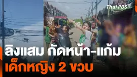ลิงแสม กัดหน้า-แก้ม เด็กหญิง 2 ขวบ